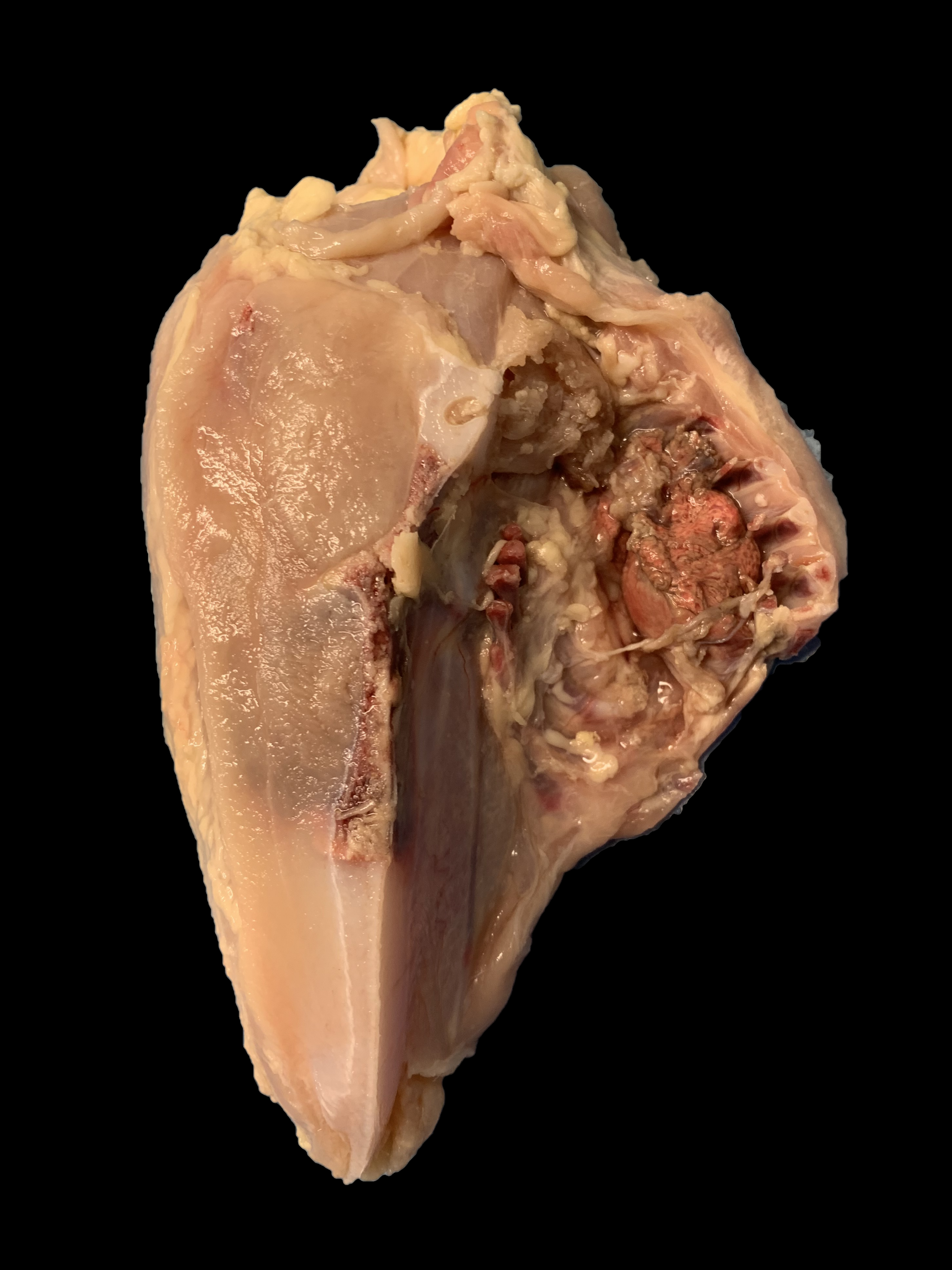 No Grade Split Breast (inside) with Large Lung 