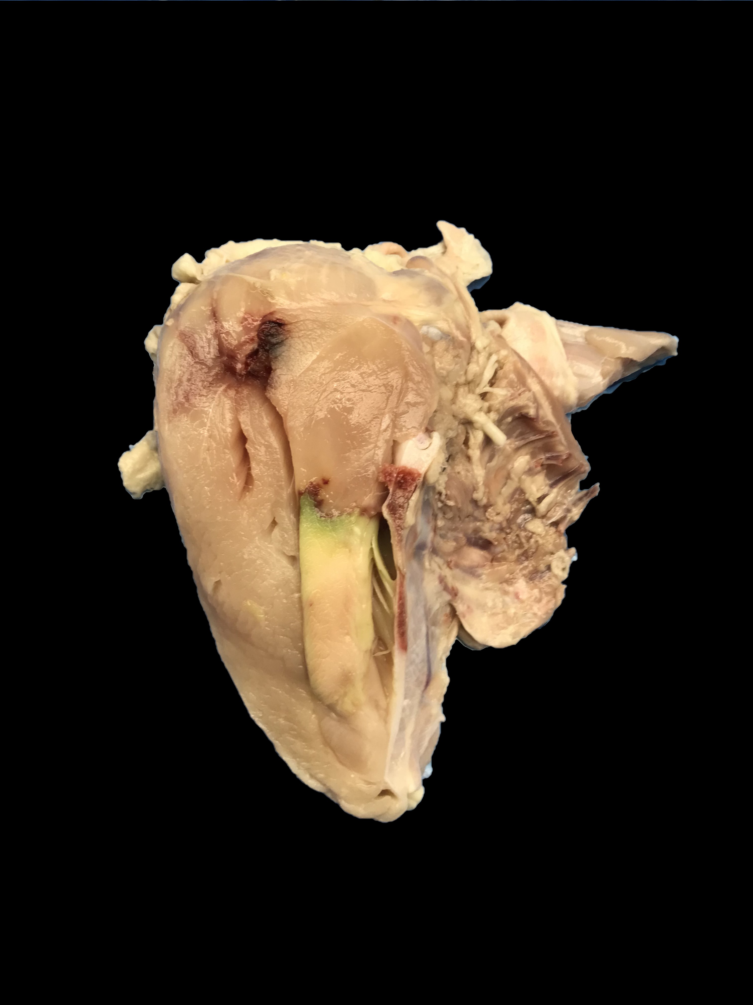 No Grade Split Breast with Green Muscle Disease